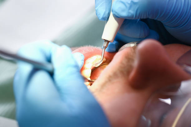 Best Walk-In Emergency Dental Services in Ypsilanti, MI