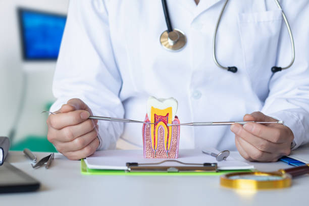Best Knocked-Out Tooth (Avulsed Tooth) Treatment in Ypsilanti, MI